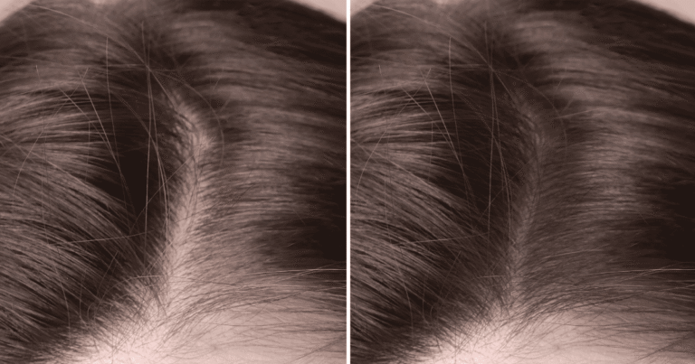 Comprehensive Women’s Hair Restoration Solutions