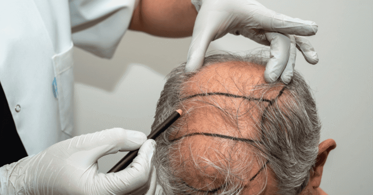 The Integration of Modern Hair Restoration Tech in Clinical Practice