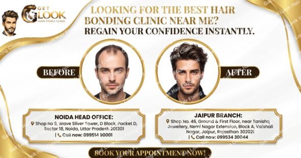 A promotional banner for Get Look Hair Fixing Clinic titled "LOOKING FOR THE BEST HAIR BONDING CLINIC NEAR ME? REGAIN YOUR CONFIDENCE INSTANTLY.". The center displays a before-and-after comparison of a man, showing hair loss transformed into a full head of hair. The bottom section lists contact details and addresses for their Noida Head Office (Sector 18) and Jaipur Branch (Vaishali Nagar), accompanied by a "BOOK YOUR APPOINTMENT NOW!" button.