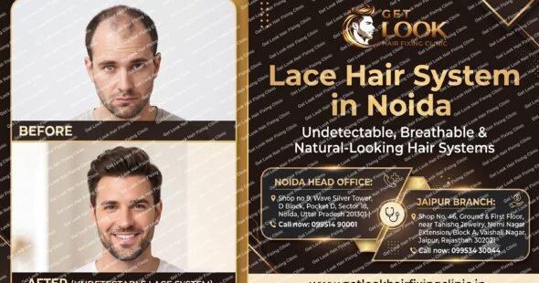 A black and gold promotional ad for Get Look Hair Fixing Clinic showing a split before-and-after portrait of a man's hair transformation using a lace hair system. Headline reads "Lace Hair System in Noida". Address and phone details for the Noida Head Office and Jaipur Branch are included at the bottom, along with the website URL www.getlookhairfixingclinic.in.