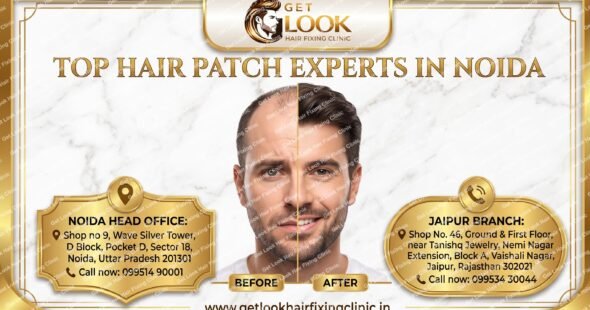 A promotional graphic for Get Look Hair Fixing Clinic featuring the headline "TOP HAIR PATCH EXPERTS IN NOIDA" over a white marble background. The center displays a split-face before-and-after portrait of a man, contrasting his hair loss on the left with a full, styled head of hair on the right. Two gold-framed plaques provide detailed contact information and addresses for the Noida Head Office and Jaipur Branch, with the clinic's website listed at the very bottom.